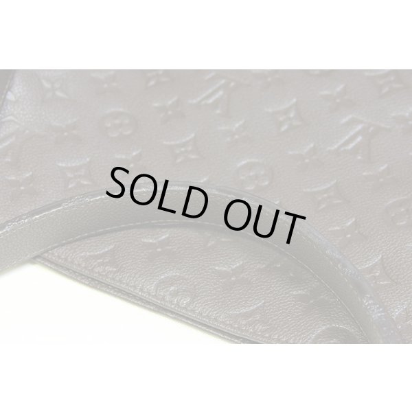 持ち手・ショルダー縁周りコーティングに、スレ・凹み跡が所々に見られます。